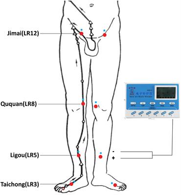 Electroacupuncture for psychogenic erectile dysfunction: A resting-state functional magnetic resonance imaging study exploring the alteration of fractional amplitude of low frequency fluctuation